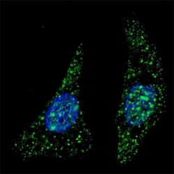 Fluorescent image of U251 cells stained with ATG5 antibody at 1:200. Immunoreactivity is localized to autophagic vacuoles in the cytoplasm.