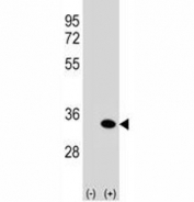 Western blot analysis of anti-ATG5 antibody and 293 cell lysate (2 ug/lane) either nontransfected (Lane 1) or transiently transfected (2) with the human gene. Predicted molecular weight ATG5: ~32 kDa; ATG5/ATG12 heterodimer: ~56 kDa.