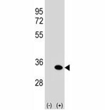 Western blot analysis of anti-ATG5 antibody and 293 cell lysate (2 ug/lane) either nontransfected (Lane 1) or transiently transfected (2) with the human gene. ATG5: ~32 kDA; ATG5/ATG12 heterodimer: ~56 kDa