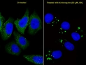 Fluorescent image of U251 cells stained with anti-ATG5 antibody diluted at 1:25 dilution. U251 cells were treated with Chloroquine (50 uM, 16h), An Alexa Fluor 488-conjugated goat anti-rabbit lgG was used as the secondary Ab (green). DAPI was used as a nuclear counterstain (blue).
