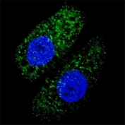 Fluorescent image of U251 cells stained with ATG-5 antibody at 1:200. Immunoreactivity is localized to autophagic vacuoles in the cytoplasm.