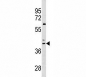 CCR4 antibody western blot analysis in HL-60 lysate. Predicted molecular weight ~41 kDa.
