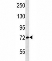 ATG7 antibody western blot analysis in Jurkat lysate. Predicted molecular weight: 70-80 kDa.