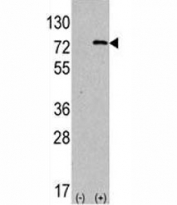 Western blot analysis of ATG7 antibody and 293 lysate transiently transfected with the human gene.