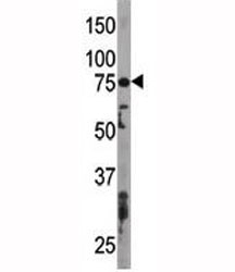Western blot testing of ATG7 antibody and mouse liver tissue lysate. Predicted molecular weight: 70-80 kDa.