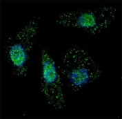 Fluorescent image of Chloroquine treated U251 cells stained with ATG7 antibody at 1:200. Immunoreactivity is localized to autophagic vacuoles in the cytoplasm.