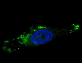 Fluorescent image of chloroquine-treated U251 cells stained with ATG12 antibody. Alexa Fluor 488 conjugated secondary was used. ATG12 immunoreactivity is localized to autophagic vacuoles in the cytoplasm.~