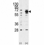 Western blot analysis of Beclin 1 antibody and 293 lysate transiently transfected with the BECN1 gene (2ug/lane).