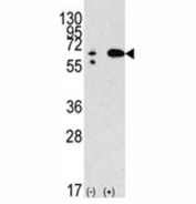 Western blot analysis of Beclin in 293 lysate transiently transfected with the BECN1 gene (2ug/lane).