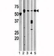 Western blot testing of Beclin antibody and (1) A2058, (2) HeLa, (3) mouse brain, (4) Y79, and (5) HL-60 lysate
