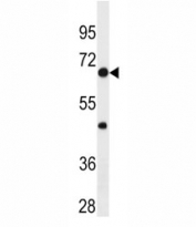 p65 antibody western blot analysis in HL-60 lysate