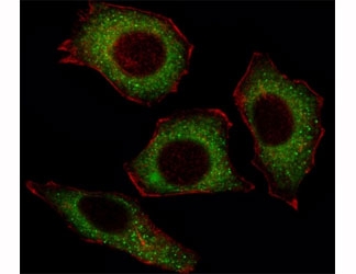 Fluorescent image of U251 cell stained with p65 antibody at 1:25. Immunoreactivity is localized to the cytoplasm.~
