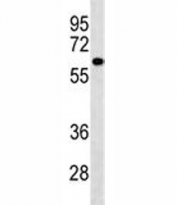 PIGS antibody western blot analysis in A549 lysate.