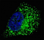 Fluorescent image of Chloroquine treated U251 cells stained with GABARAP antibody. Alexa Fluor 488 secondary (green) was used. Nuclei were counterstained with Hoechst 33342 (blue) (10 ug/ml, 5 min). GABARAP immunoreactivity is localized to autophagic vacuoles in the cytoplasm.