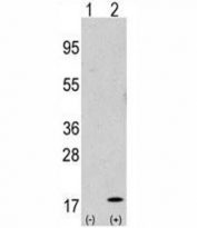 Western blot analysis of GABARAP antibody and 293 cell lysate either nontransfected (Lane 1) or transiently transfected with the GABARAP gene (2).