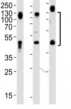 Western blot analysis of lysate from HeLa, HT1080 and human placenta lysate (left to right), using LAMP1 antibody at 1:1000. This heavily glycosylated protein of 417 amino acids is visualized at up to 140KD.~