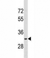 NKX6.2 antibody western blot analysis in K562 lysate.