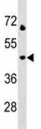 LAMP3 antibody western blot analysis in Jurkat lysate.  Predicted molecular weight: ~44 kDa.