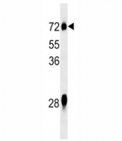 NOX3 antibody western blot analysis in mouse liver tissue lysate.