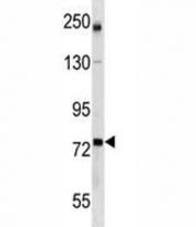 GCLC antibody western blot analysis in mouse bladder tissue lysate