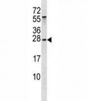 RAB5B antibody western blot analysis in mouse liver tissue lysate