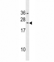 RAB5B antibody western blot analysis in HepG2 lysate.