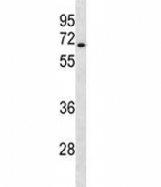 HAS3 antibody western blot analysis in A549 lysate. Predicted molecular weight ~ 63 kDa.