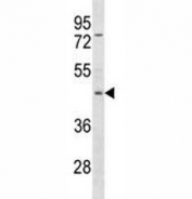 Anti-FOXP3 antibody western blot analysis in CEM lysate