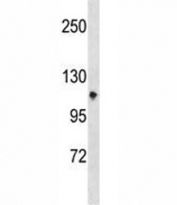 Integrin alpha 7 antibody western blot analysis in CEM lysate.
