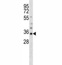 Olig1 antibody western blot analysis in mouse heart tissue lysate. Predicted size 25~35 kDa