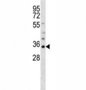Olig1 antibody western blot analysis in mouse heart tissue lysate. Predicted size 25~35 kDa