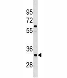 XRCC4 antibody western blot analysis in A549 lysate