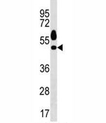 Sgk1 antibody western blot analysis in HeLa lysate.