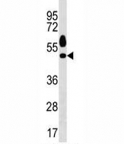 Sgk1 antibody western blot analysis in HeLa lysate.