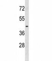 S1PR2 antibody western blot analysis in NCI-H292 lysate.