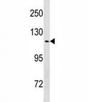 TRPV4 antibody western blot analysis in HeLa lysate.