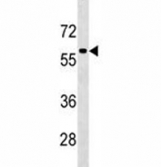TFEB antibody western blot analysis in HepG2 lysate. Expected molecular weight: 53-60 kDa (unmodified), 65-70 kDa (modified).