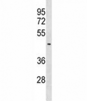 SUV39H2 antibody western blot analysis in MDA-MB453 lysate. Expected molecular weight: 40-53 kDa.