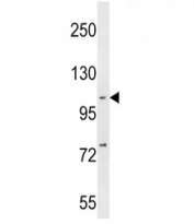 NFKB1 antibody western blot analysis in MDA-MB231 lysate. Expected molecular weight: 105 kDa.