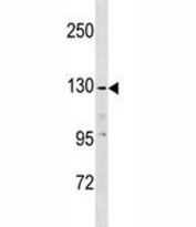Anti-EGF antibody western blot analysis in K562 lysate. Predicted band size : 134 kDa but routinely observed at 134-160kDa.