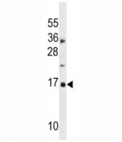 CDKN2A antibody western blot analysis in MDA-MB453 lysate.