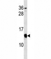 Cdkn2a antibody western blot analysis in mouse spleen tissue lysate.