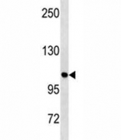 ULK1 antibody western blot analysis in HeLa lysate. Predicted molecular weight: 112-150 kDa.
