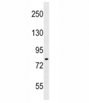 IKK antibody western blot analysis in A549 lysate. Predicted molecular weight ~85 kDa.