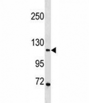PR antibody western blot analysis in 293 lysate. Expected molecular weight: 82-94 kDa (isoform A) and 99-120 kDa (isoform B).