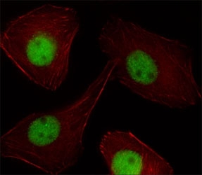 Fluorescent image of U251 cell stained with PR antibody at 1:25. Immunoreactivity is localized to the nucleus strongly and vesicles weakly.~