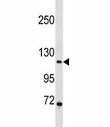 PR antibody western blot analysis in 293 lysate. Predicted molecular weight ~99 kDa.