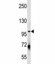 ULK1 antibody western blot analysis in U251 lysate. Predicted molecular weight: 112-150 kDa