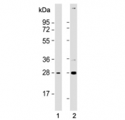 Western blot testing of 1) mouse brain and 2) mouse lung lysate with Trem2 antibody. Predicted molecular weight ~25 kDa.