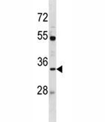 AQP3 antibody western blot analysis in MDA-MB453 lysate